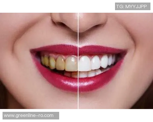 轻松实现五杀的秘诀是什么还有比这更简单的方式吗